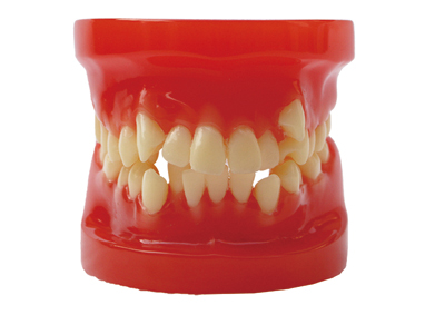 HST-B4 Orthodontic Model