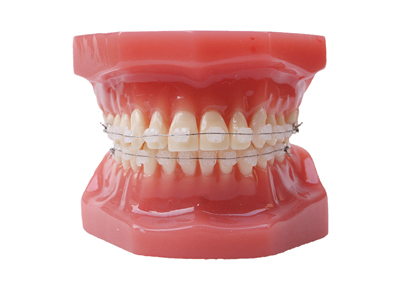 HST-B6-03 Ortho Ceramic Bracket Model