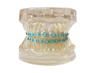 HST-B7-03 Ortho Ceramic Bracket Model