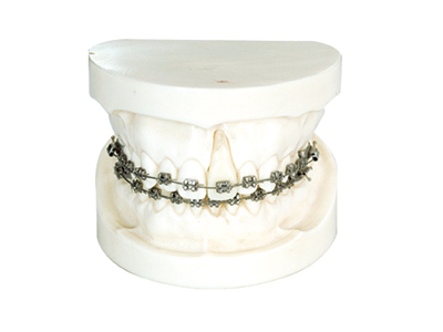 HST-B10 Ortho With Edgewise Bracket Model