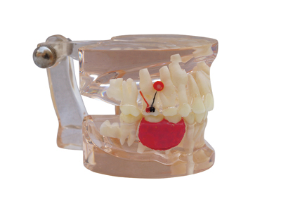 HST-C8 Clear Mixed Age With Missing teeth Model