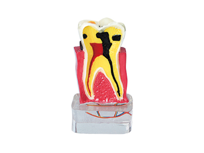 HST-C18 4times periodontal with Nerve