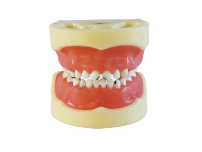 HST-E10 Caries model of Child