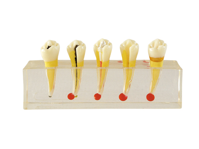 HST-M5 Dental Pulp Disease Clinical Model