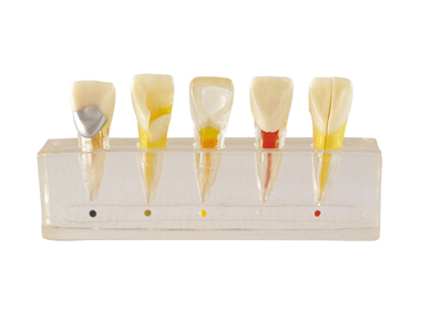 HST-M6  Dental Pulp Disease Clinical Model